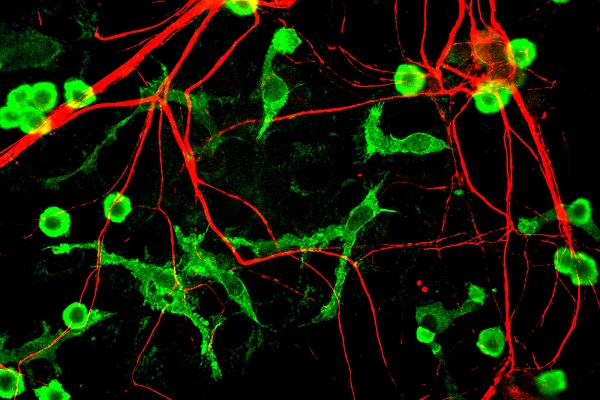 neurons-and-glia-cells