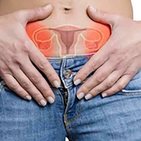 dermoid-cyst_ovary_womens-health copy