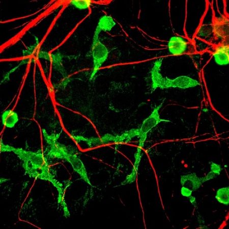 neurons-and-glia-cells